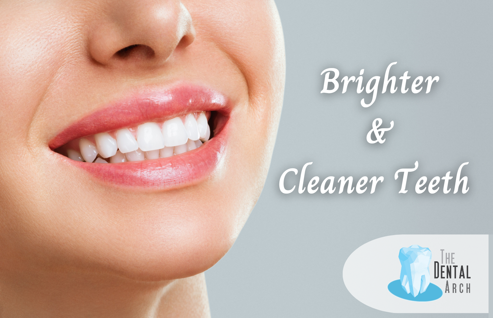 Teeth Scaling and Polishing Cleaning in Bandra